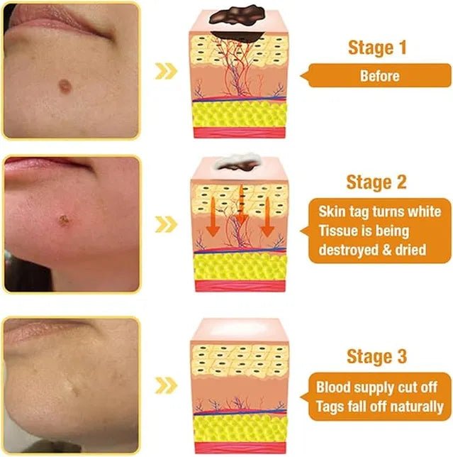 Zidella Skin Lighting Blemish Cream 50g (Pack of 2) - Namma Angadi